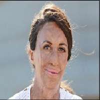 Turia Pitt